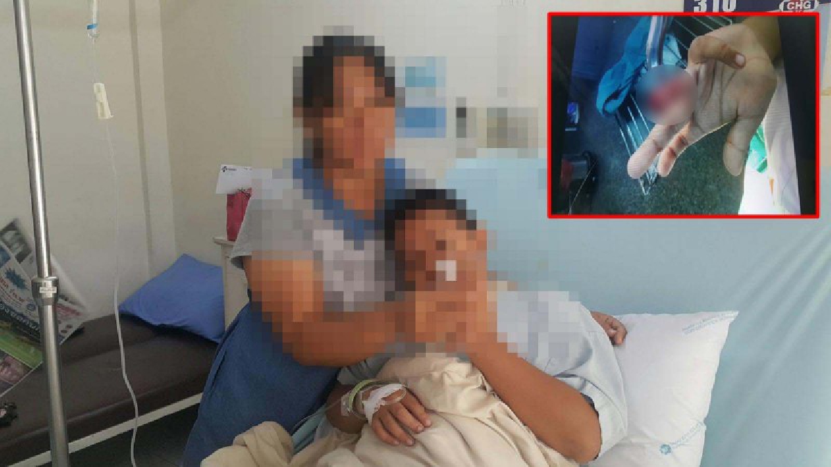 เอาเรื่องให้ถึงที่สุด!! แม่เด็กป.3 โร่แจ้งความตร. หลังลูกชายถูกเพื่อนปิดประตูหนีบจนนิ้วขาด แต่ทางรร.ไม่แยแส แถมปฎิบัติกับเด็กได้สุดทน (คลิป)