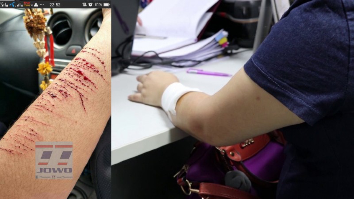 โรคจิตชัดๆ!!พยาบาลสาวโดน 3วัยรุ่นจี้ชิงทรัพย์ เข้าให้ปากคำ 1ใน3 แฉคนร้ายปากแว้ง ใช้มีดกรีดแขนไปพลางร้องไปพลาง มีความสุขเมือเห็นเหยื่อเจ็บปวด
