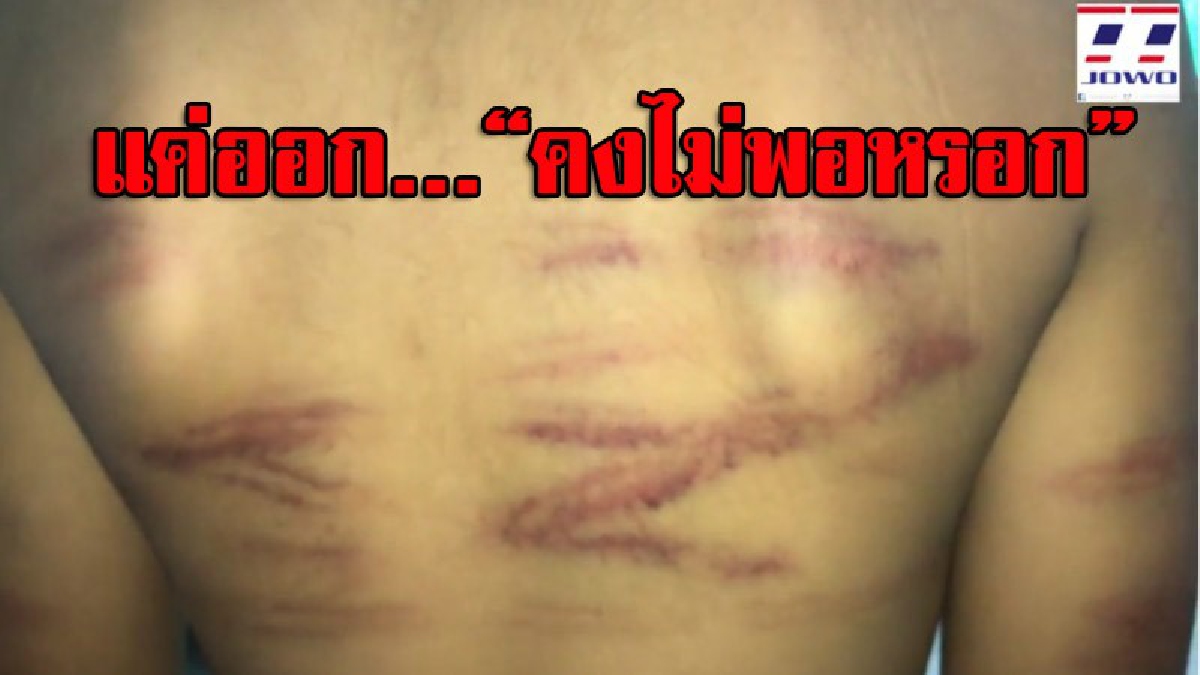 ต้านกระแสสังคมไม่ไหว!! ครูโหดใช้ไม้เรียวฟาดเด็กป.1ไม่ยั้ง ด้วยเหตุแค่หยิบปากกา ยื่นหนังสือออกจากราชการแล้ว ผู้ปกครองยังผวาหนัก ปิดบ้านหนี