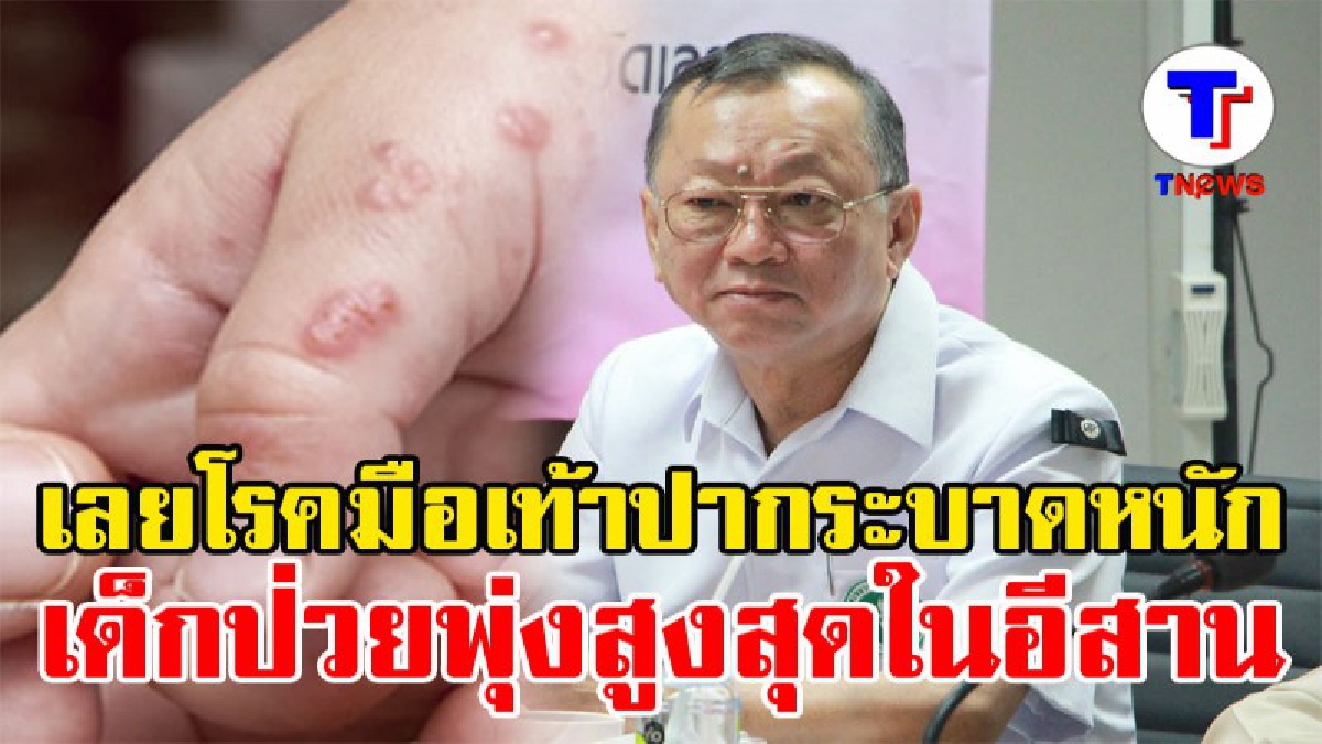 ร่วมกันป้องกัน!! นพ.สสจ.เลยเผย พบเด็กป่วยเป็นโรคมือเท้าปาก ยอดป่วยพุ่งสูงสุดในอีสาน และเป็นอันดับที่ 5 ของประเทศ (ชมคลิป)