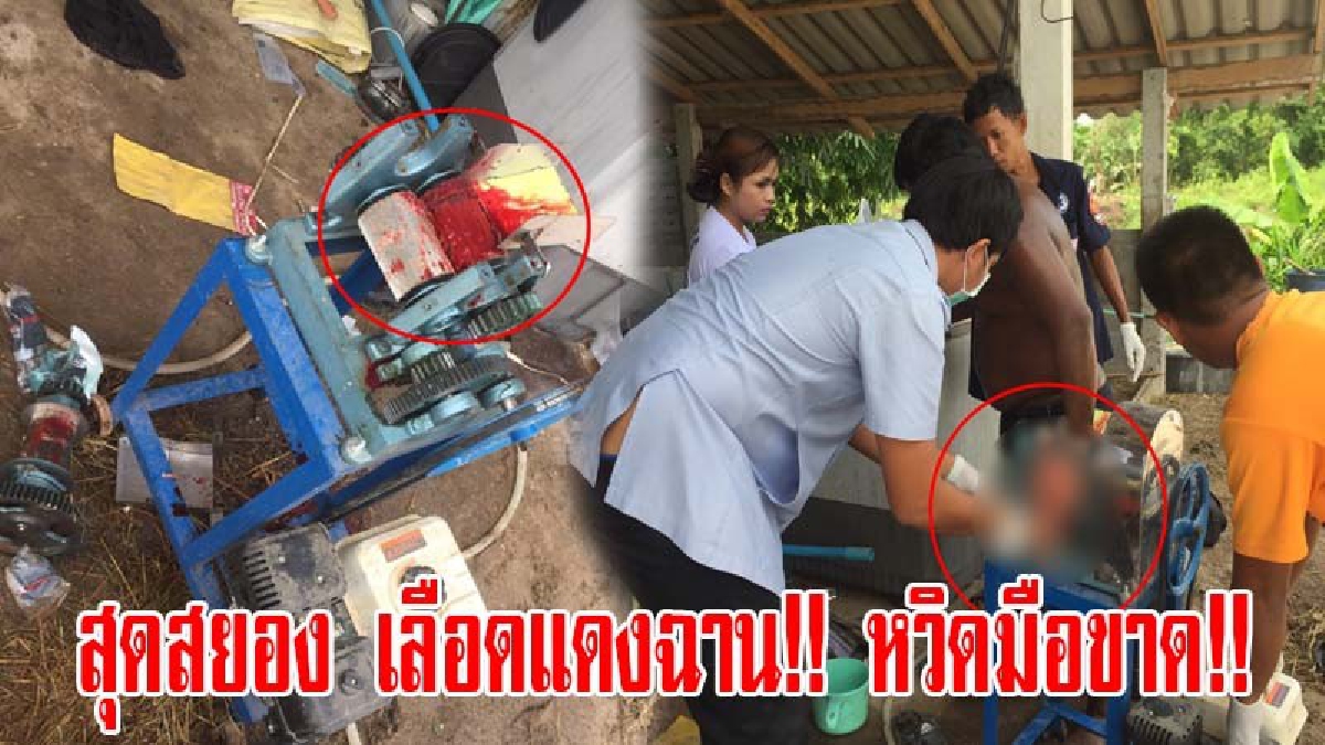 สุดสยอง เลือดแดงฉาน!! หนุ่มใหญ่ กรีดร้องด้วยความเจ็บปวด หลังเครื่องบดปลา ดูดมือบดเละ อาการสาหัส จนท.เร่งช่วยเหลือ (มีคลิป)