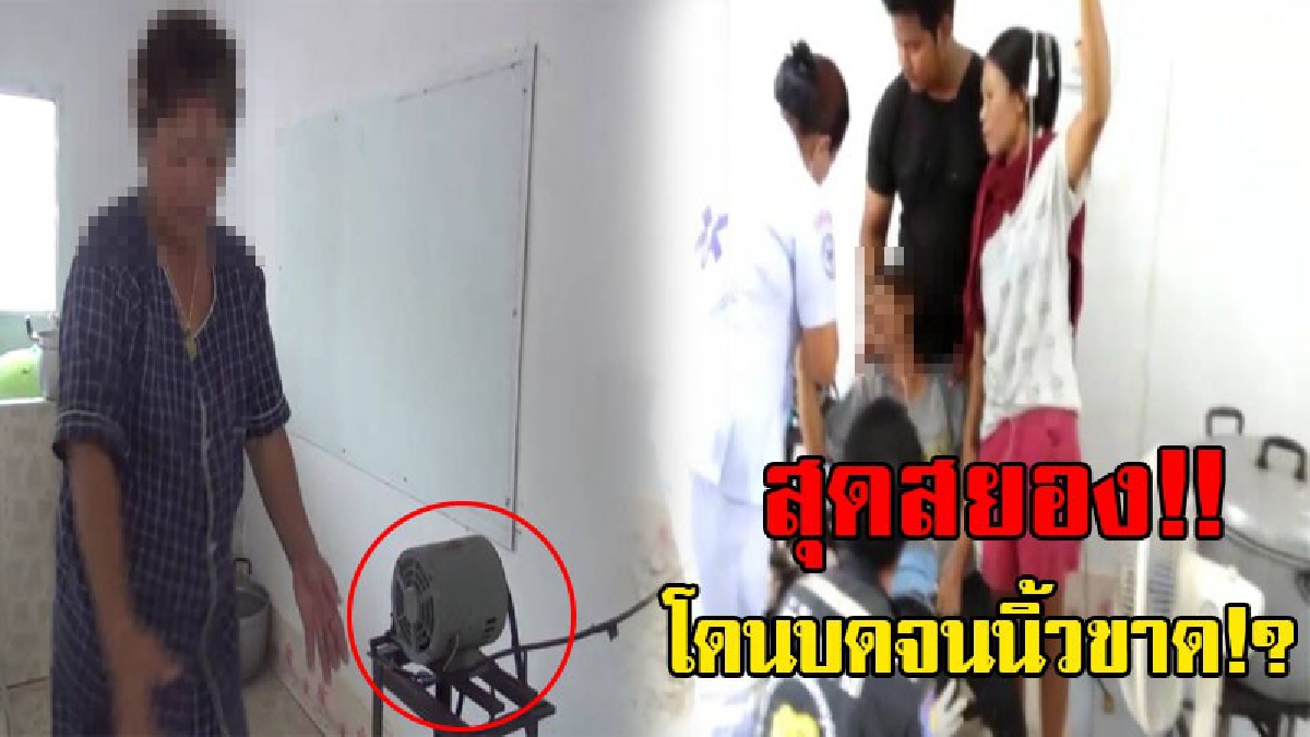 สุดระทึก!! พนักงานสาวประมาท เอาว่านหางจระเข้ใส่เครื่องบด เกิดมือลื่นติดเครื่อง ร้องลั่น โดนบดสด หนีบกระดูกแตกละเอียด นิ้วขาด 3นิ้ว!?(ชมคลิป)