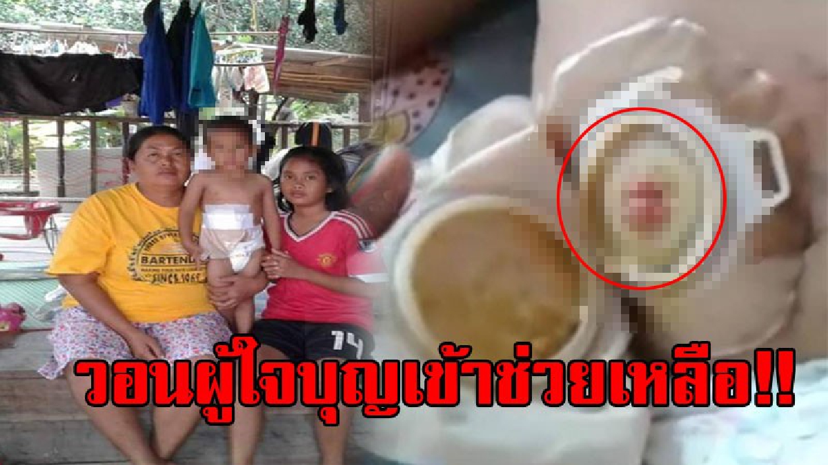 ช่วยน้องด้วย!? วอนผู้ใจบุญเข้าช่วยเหลือน้อง "บุญรอด" ที่ต้องเผชิญกับสารพัดโรค ซ้ำร้ายน้องต้องเจาะหน้าท้องเพราะไม่มีรูทวาร!? (ชมคลิป)