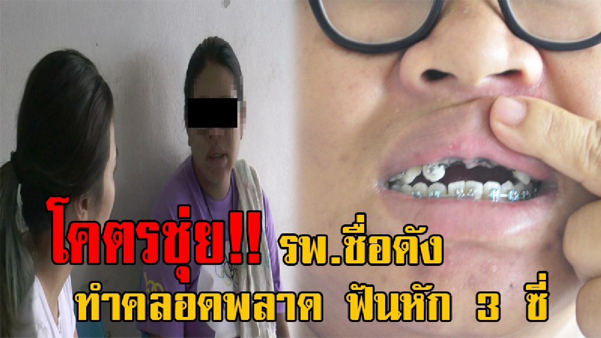 งามหน้าอีกแล้ว!! สาววัย29 โวยแพทย์ รพ.ดัง ทำคลอดพลาด ฟันหัก 3 ซี่ ขณะใส่ท่อช่วยหายใจ เผยพร้อมรับผิดชอบ ระบุเป็นภาวะแทรกซ้อนในการรักษา!?