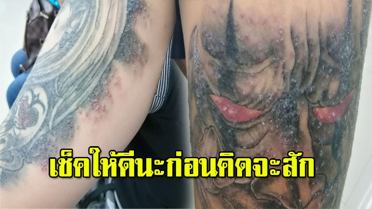 ผู้เสียหายนับ 10 บุกแจ้งความเอาผิดร้านสักชื่อดัง หลังสักแล้วเป็นแผลพุพองขึ้นเต็มรอย ช่างเผยสาเหตุ..พูดได้คำเดียวสุดชุ่ย (มีคลิป)