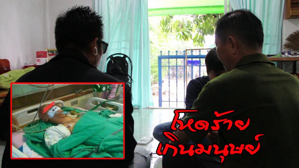 #แค้น ..! พ่อเด็กวัย 15 ร้องสื่อช่วย หลังลูกชายถูกการ์ดผับดังรุมทำร้าย ราดน้ำมันจุดไฟเผาขา ทุบตีจนต้องผ่าตัดสมอง