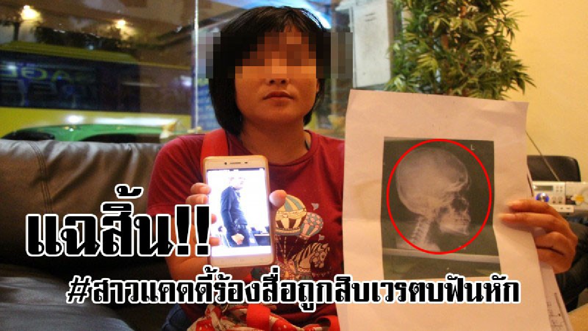 #ขอความเป็นธรรม..!! สาวแคดดี้ร้องสื่อ หลังถูกสิบเวรตบฟันหัก เกรงไม่ได้รับความเป็นธรรม แถมแฉซ้ำโดนเรียกรับค่าเยี่ยมนอกเวลา-ค่าโทรศัพท์ (คลิป)