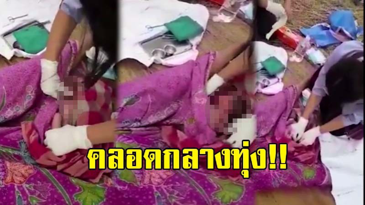 ยังดีที่มาทัน..!! หญิงท้องแก่ปวดท้องหนัก ขณะเกี่ยวข้าว เจ้าหน้าที่ รพ.สต. มาทันเวลา..เร่งทำคลอดกลางทุ่ง ปลอดภัยทั้งแม่และลูก