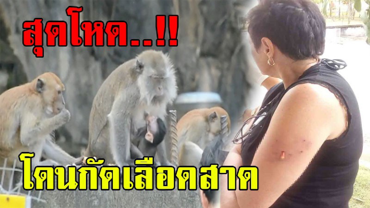 โคตรโหด..!? เจอแบบนี้ทำกลัวไปอีกนาน ลิงจ่าฝูงรุมกัดนทท.ชาวรัสเซียเลือดสาด มีชิ้นเนื้อหลุดติดบริเวณแขน..!!