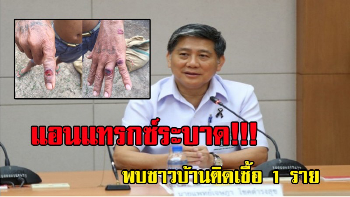 ผลตรวจมาแล้ว !!! กรมวิทยาศาสตร์การแพทย์ยัน..ชาวบ้านแม่โกนเกนติดเชื้อแอนแทรกซ์ ผลเป็นบวก 1 จาก 3 ราย ส่วนอีกรายยังรอผล