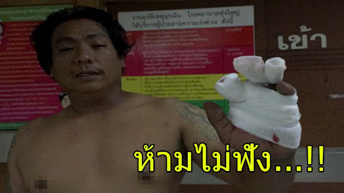 หนุ่มสวนยาง จุดระเบิดปิงปองฉลองปีใหม่ กะยิงหนังสติ๊กให้ระเบิดบนท้องฟ้า พลาดท่า..บึ้มใส่มือ นิ้วเกือบขาด (มีคลิป)