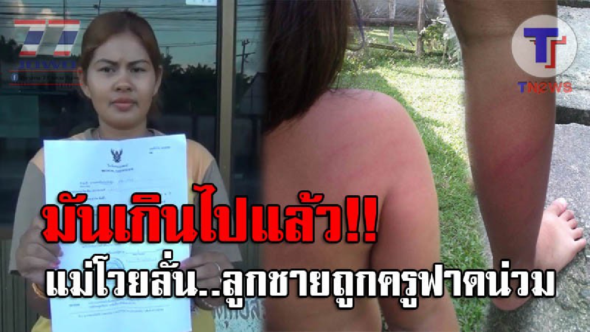 ไร้จรรยาบรรณสิ้นดี..! แม่สุดทน จูงลูกชายวัย 4 ขวบ เข้าแจ้งความ หลังถูกครูโหดฟาดจนน่วม เผยถูกเตือนหลายครั้งแต่ไม่ฟัง เตรียมสั่งสอบด่วน (คลิป)
