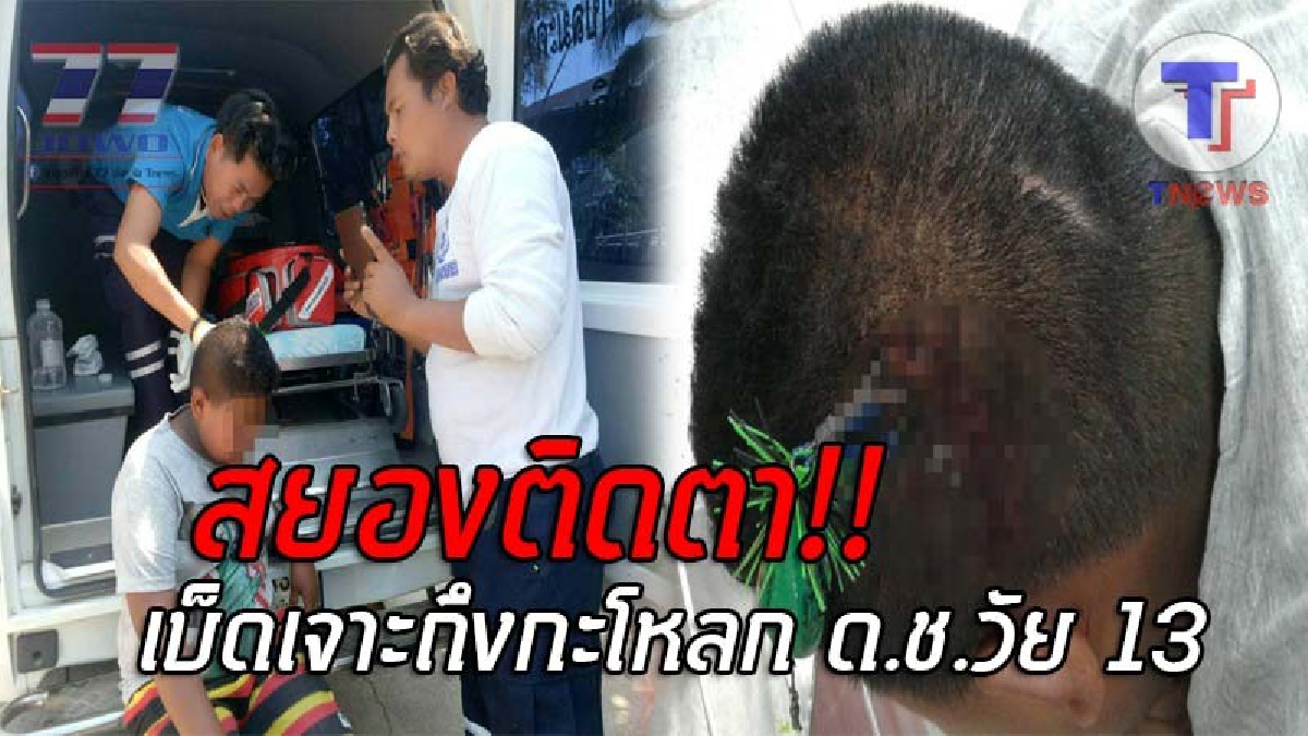 อุทาหรณ์จำจนตาย..! เผยภาพสุดหวาดเสียว หลังเบ็ดฝรั่งเกี่ยวหัว ด.ช.วัย13 ช็อคหนัก เจาะลึกถึงกะโหลก แถมทำหวิดตาบอด!? (ชมคลิป)
