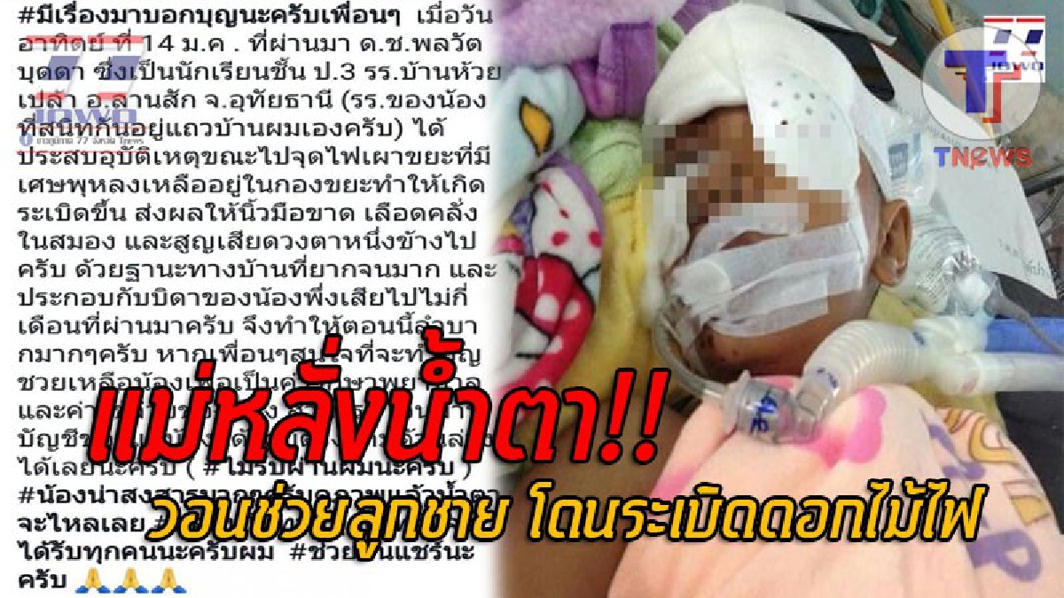 หัวอกแม่เจ็บยิ่งกว่า..!! เหตุสลด ด.ช.ป.3 จุดไฟเผาขยะ แต่ดวงซวย มีเศษดอกไม้ไฟปนอยู่ เกิดระเบิดขยี้ร่างยับ อาการสาหัส แม่วอนสังคมช่วยเหลือ!?