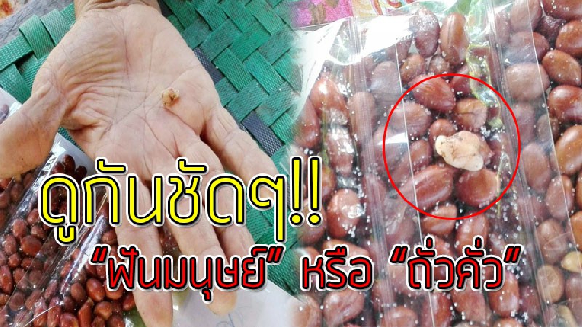 อ้วกแทบพุ่ง!? หนุ่มใหญ่ขับรถไปซื้อ "ถั่วคั่ว" มาแกล้มเหล้า เปิดแกะกินกันมันส์ปาก แต่ต้องชะงัก เคี้ยวโดนของแข็ง คายออกมาเป็น "ฟันมนุษย์" !!