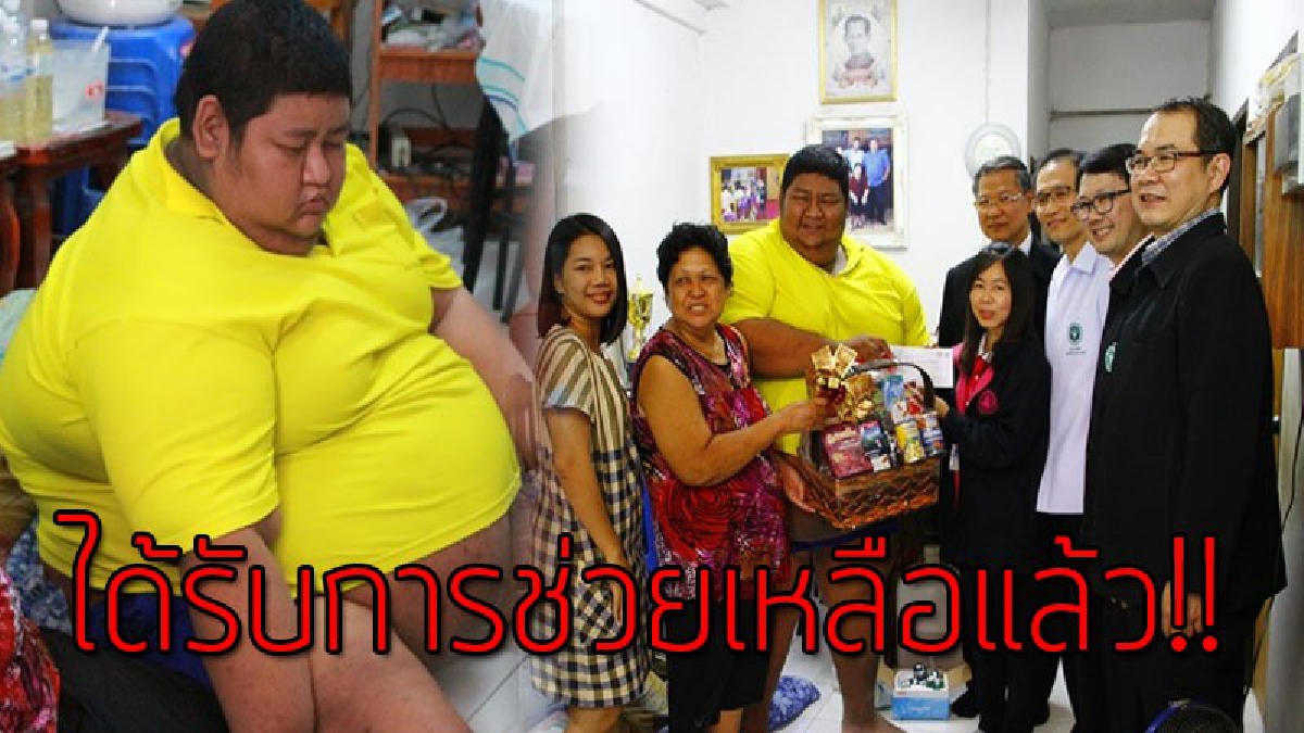 เหมือนฟ้ามาโปรด!?? อธิบดีกรมการแพทย์ รุดช่วยเหลือเด็กอ้วน เนื่องจากอายุเพียง 20 แต่มีน้ำหนักตัว 250 ก.ก. เตรียมส่งผ่าตัดกระเพาะอาหารออก 90%