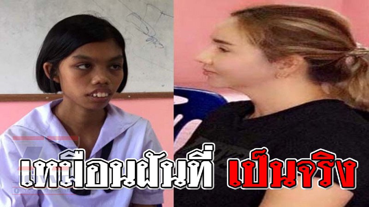 กราบหัวใจ ! สาวสวยนักธุรกิจใจบุญ ช่วยสานฝัน "น้องฟีฟ่า" สาวน้อย ม.3 ทุ่มเงินเพื่อช่วยรักษาอาการ “ฟันเหยิน” จนกว่าจะหาย..!? (ชมคลิป)