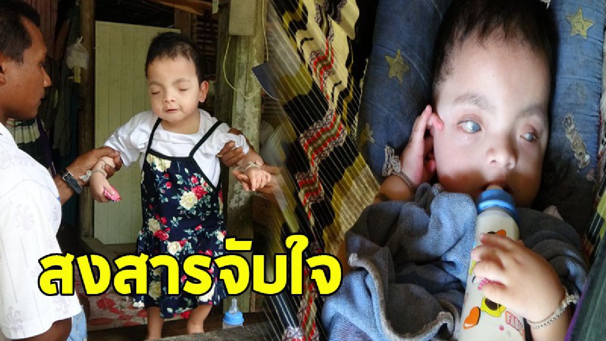 วอนช่วยเหลือ 2 หนูน้อย เลนส์นัยน์ตาดับสนิทตั้งแต่แรกเกิด พร้อมโรคเส้นเลือดหัวใจตีบและสารพัดรุมเร้า ท่ามกลางครอบครัวฐานะยากจน