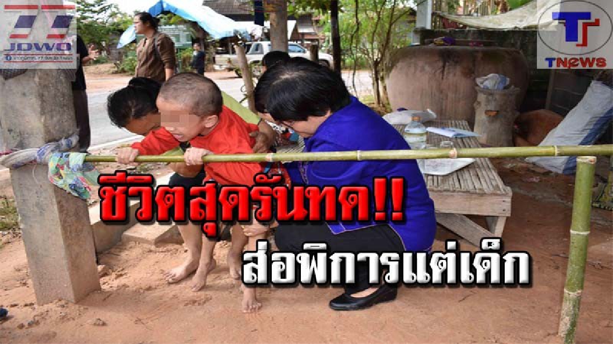 สงสารจับใจ!! หนูน้อยวัย 5 ขวบส่อพิการ หลังประสบอุบัติเหตุเบ้าสะโพกหลุด ไม่ยอมลุกเดินร่วม 2 เดือน (คลิป)
