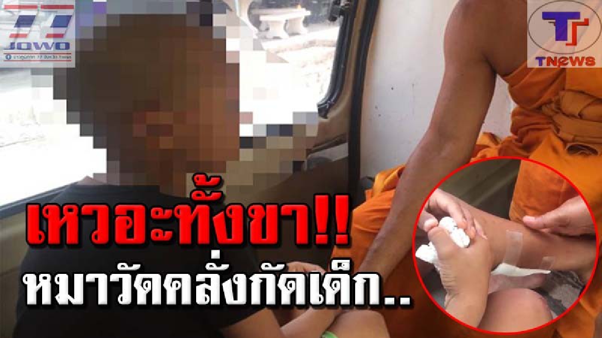 ยังไม่ทันห่มผ้าเหลือง !! หมาวัดคลั่ง กระโจนกัดเด็ก 6 ขวบเตรียมตัวบวชเณรช่วงถดูร้อน ด้านพระยันหมดห่วง "ไม่เป็นอันตรายแน่นอน"!? (มีคลิป)