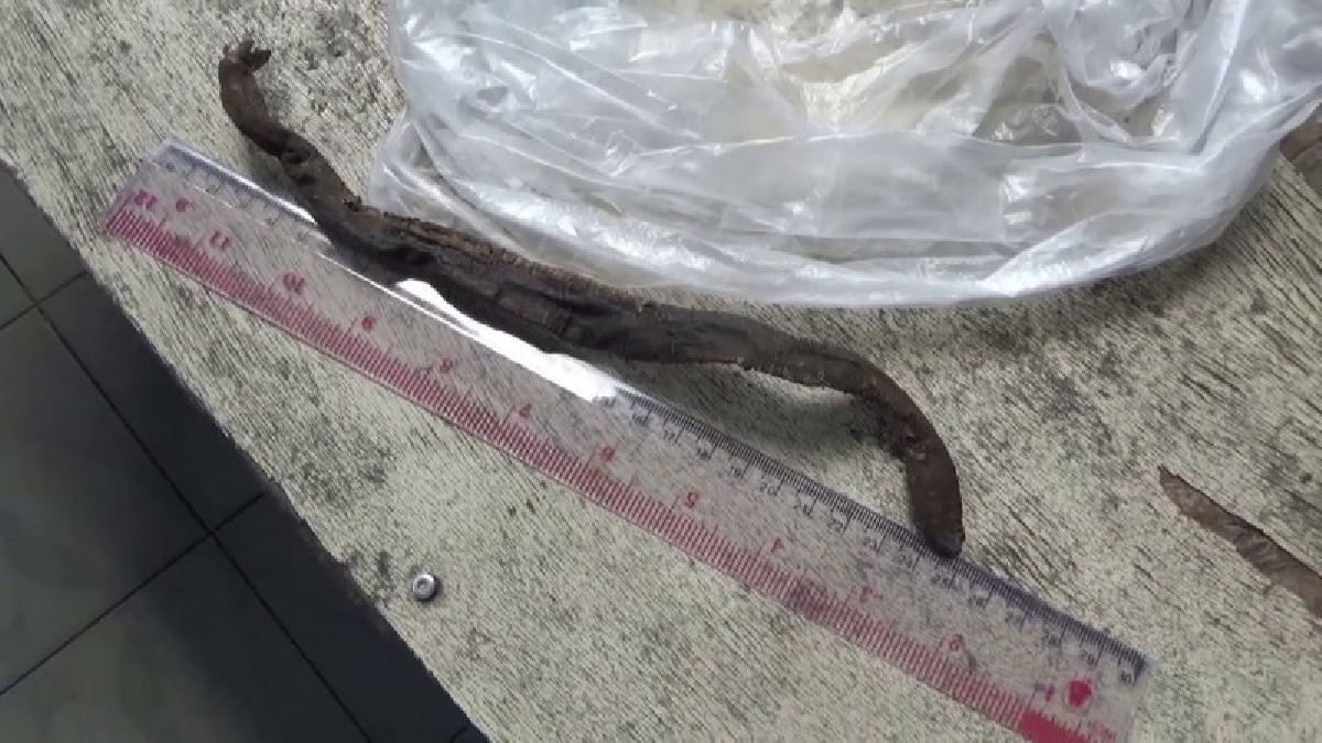 ชาวบ้านผวา ปลิงกัดคนจนตาย หลังไม่ยอมไปโรงพยาบาล นาน 5 วันแผลบวมทั้งขาก่อนเสียชีวิต