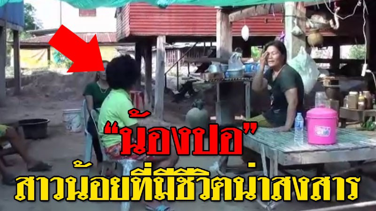 ต้นทุนชีวิตต่างกัน ! สุดสารจับใจ "น้องปอ" เด็กหญิงที่พิการทางปากและฟัน มีขนขึ้นดกดำทั่วร่าง รับความทรมานมาตั้งแต่เกิด..!? (ชมคลิป)