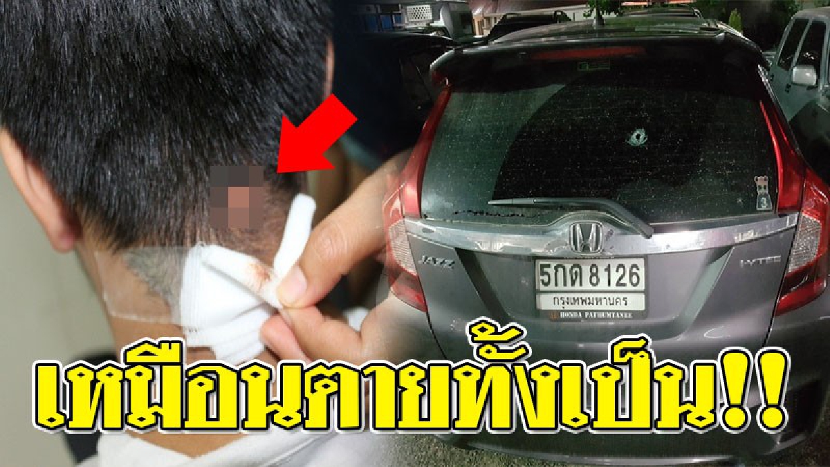 แผลเป็นกลางใจ ! พี่สาวของหนุ่มที่โดนยิงผิดตัว ร้องช่วยน้องชายด้วย ล่าสุดยังผ่าตัดกระสุนปืนออกไม่ได้ เผย..ผู้ต้องหาเป็นถึงผู้ช่วยผู้ใหญ่บ้าน!