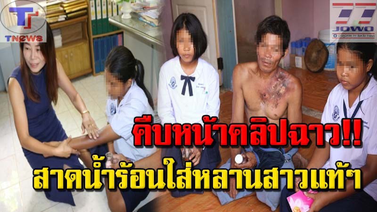 ชาวโซเชียลแห่แชร์คลิปสะเทือนใจ ป้าแท้ๆ สาดน้ำร้อนใส่สามพ่อลูกจนบาดเจ็บ หนำซ้ำมีฐานะยากจนไม่มีไฟฟ้าใช้หลายปีวอนผู้ใจบุญช่วยเหลือ