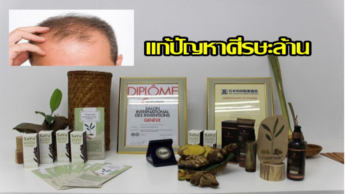 สุดยอดคนไทย !! นักวิจัยไทย ค้นพบสมุนไพรแก้ปัญหาหัวล้าน ไม่มีสารตกค้าง ได้ผลดี อย่างน่าตกใจ
