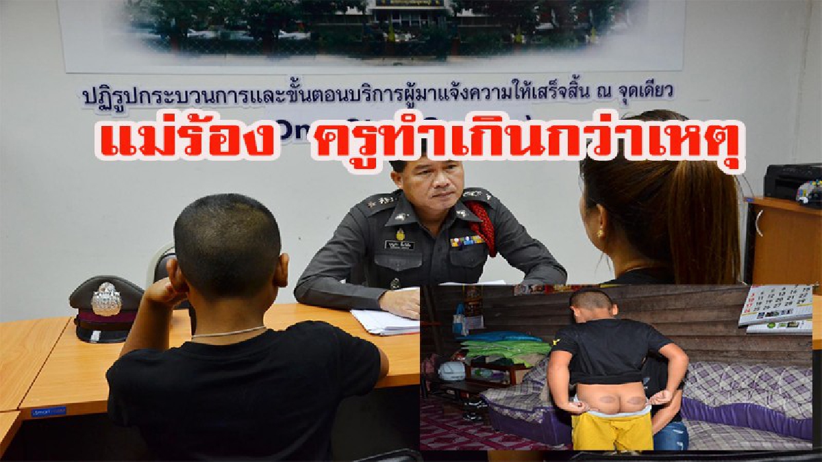 หัวอกคนเป็นแม่!!!! ลูกเจ็บแม่ก็เจ็บ.....แม่เดือดแจ้งความเอาผิดครูสอนภาษาอังกฤษตีลูกชาย ป.4 ไม่ส่งการบ้าน ทำเกินกว่าเหตุไปไหม!!