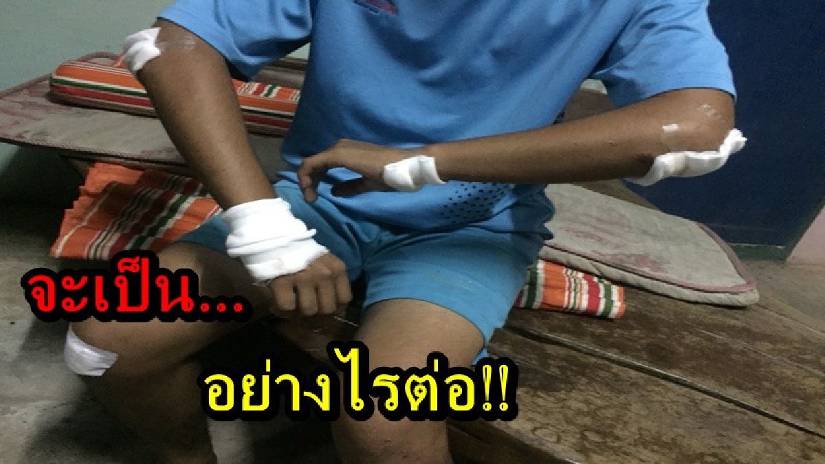จะเป็นอย่างไรต่อ!! วัยรุ่นถูกอาสาตำรวจเบียดชน เผยตนและพี่ชายถูกทำรุนแรงเกินกว่าเหตุ พร้อมแจ้งข้อหาพยายามฆ่ากลับ