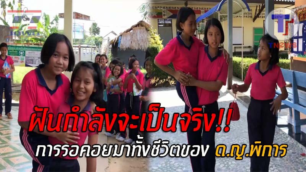 เตรียมสานฝันให้เป็นจริง..! มูลนิธิ รพ.สงขลานครินทร์ ร่วม ม.อ. ทำขาเทียมให้ ด.ญ.พิการวัย12 ที่เพื่อนช่วยอุ้ม สามารถกลับมาเดินได้ (ชมคลิป)