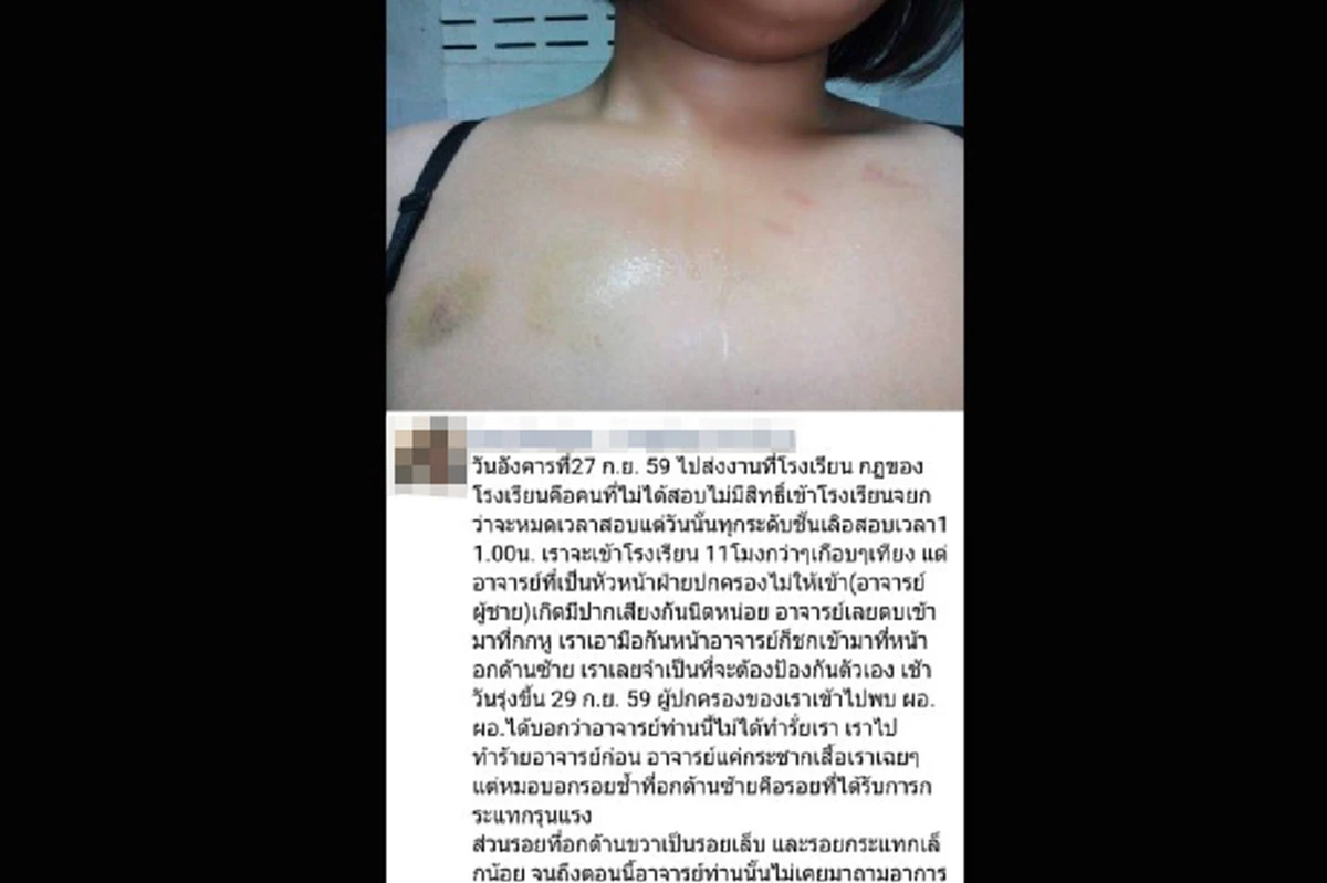 เอาให้ถึงที่สุด!!! นร.ม.5 ชัยนาท แจ้งความครูฝ่ายปกครอง หลังถูกตบกกหู-ชกหน้าอก ด้านผอ.เผยครูมีนิสัยใจร้อน ชอบลงโทษเด็กรุนแรง!!!