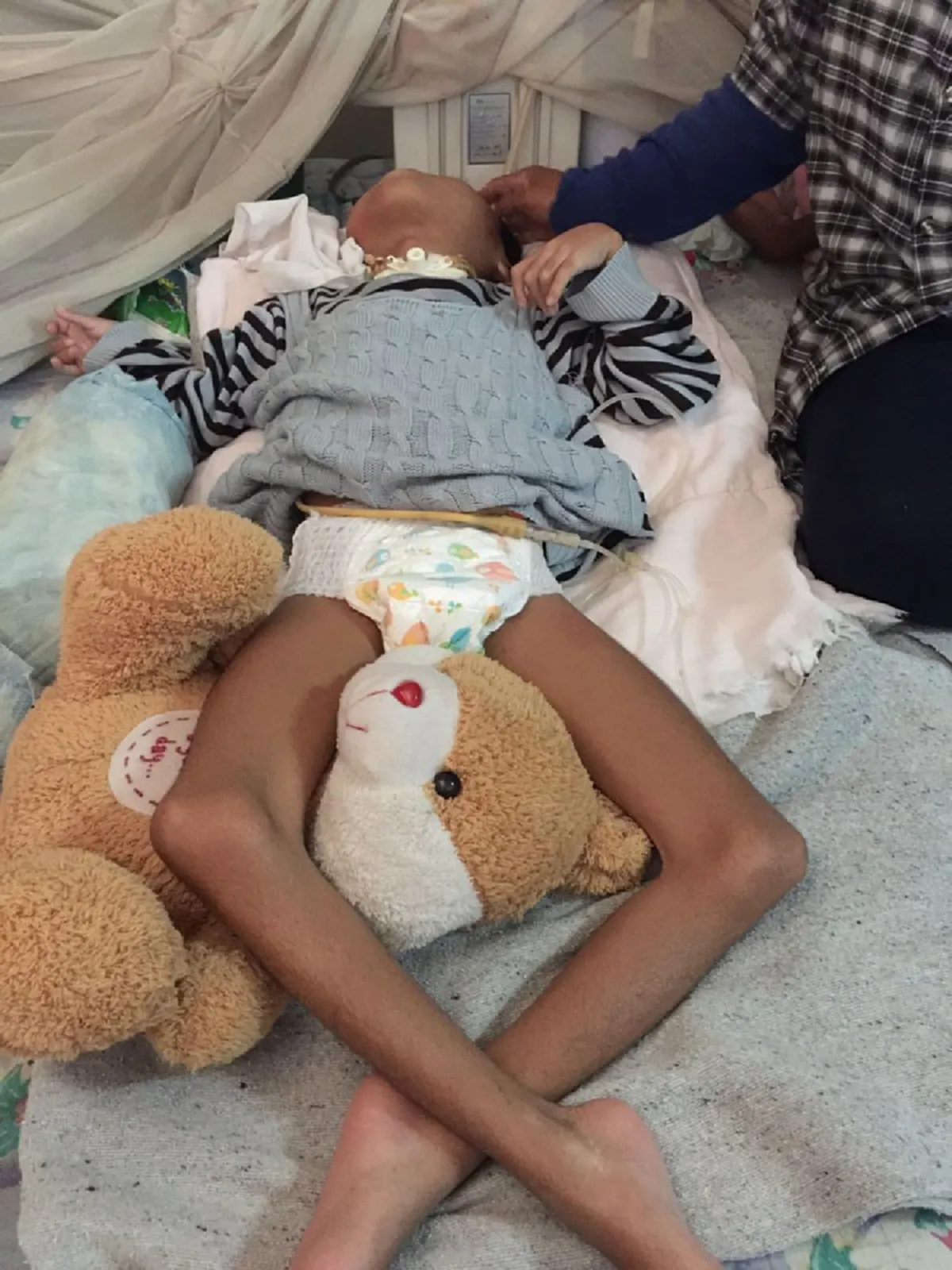 สุดเวทนามีลูกกี่คนก็พิการ!! สาวโคราชท้อใจ กลางวันต้องทิ้งลูกน้อยพิการไว้ลำพังเพื่อหาเงินเลี้ยงปากท้อง วอนผู้ใจบุญช่วยเหลือ