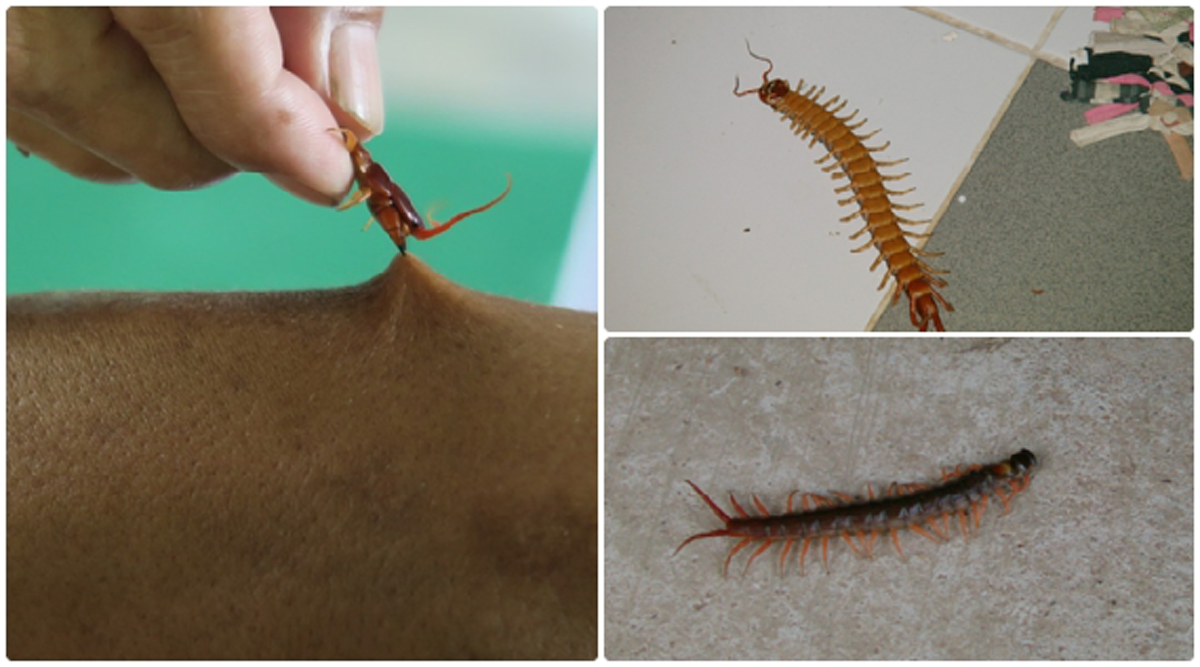 แชร์เก็บไว้ด่วน!! วิธีปฐมพยาบาลเมื่อโดนตะขาบกัด เพียงแค่ใช้สมุนไพร...ได้ผลดีจริง หายเร็วมากๆ