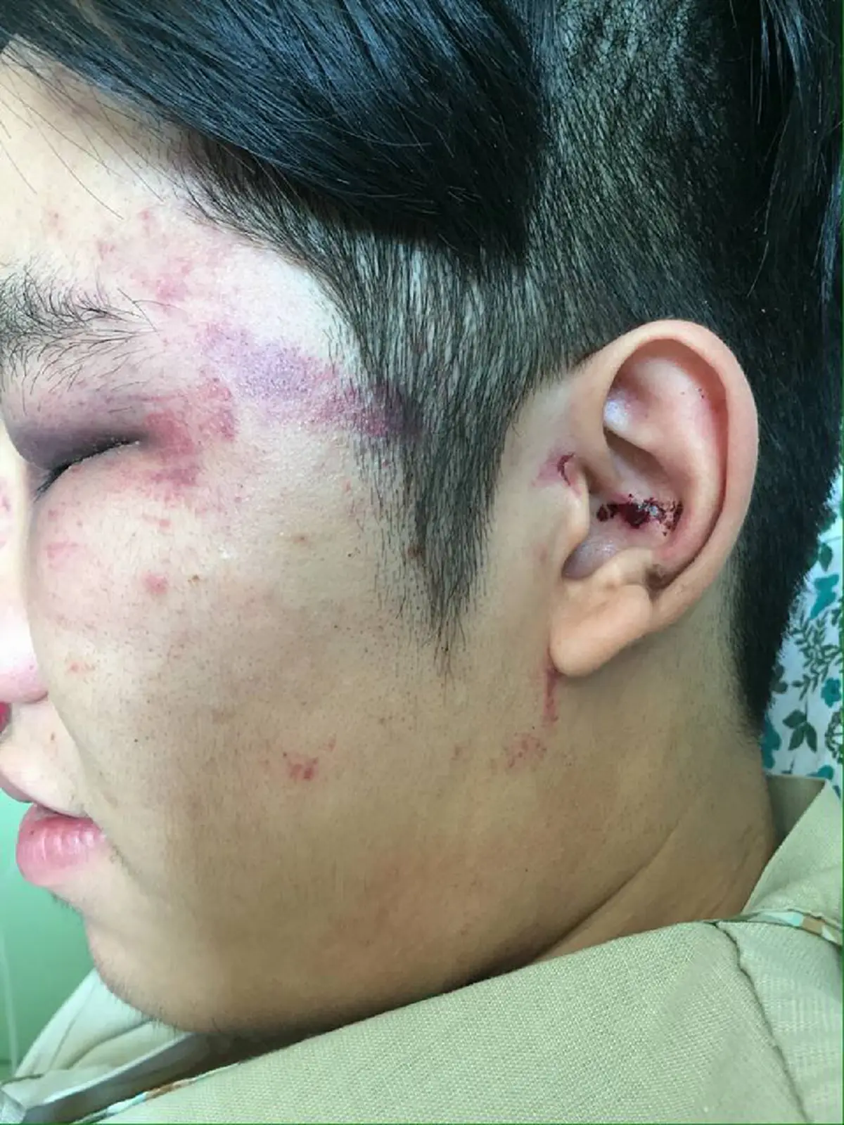 หนังคนละม้วน!!!  "เพื่อนสนิทลูกนายพล" เผยความจริงอีกด้าน งงกับเรื่องดาราสั่งกระทืบ พวกชอบมโนควรอ่าน!!! (รายละเอียด)