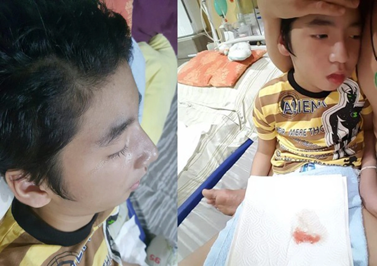 ใต้ความฮาที่เต็มไปด้วยน้ำตาของลูกชาย..."พ่อน้องอิคคิว" โพสต์เศร้า ประกาศหยุดไลฟ์เฟซบุ๊กชั่วคราว เหตุน้องอิคคิวเลือดกำเดาไหลไม่หยุด!!!