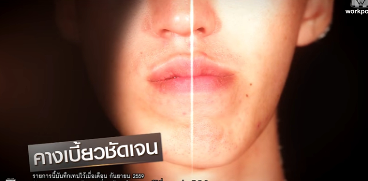 ผลแห่งการทำดี!!! "ครูผู้เสียสละ" กับความโชคร้ายของใบหน้า โชคดีได้พลิกชีวิต Let me in จากครูหน้าเบี้ยวเปลี่ยนเป็นโอปป้าทำตะลึงทั้งสตูฯ (คลิป)