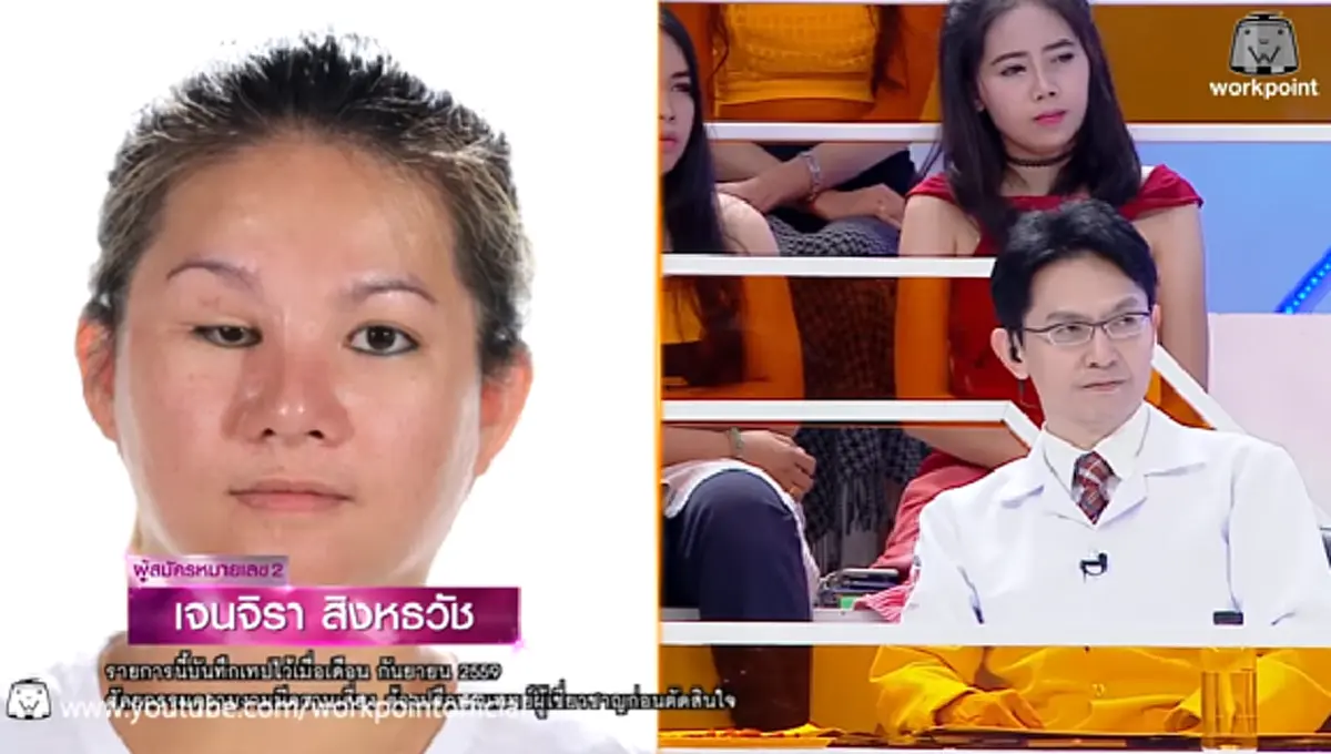 เหมือนได้ชีวิตใหม่!!! "สาวโชคร้าย" ประสบอุบัติเหตุตาขวาบอด พลิกชีวิต! เปลี่ยนเป็นสาวสวยกับ "ดวงตาใหม่" ที่มั่นใจและมีความสุขมากขึ้น (คลิป)
