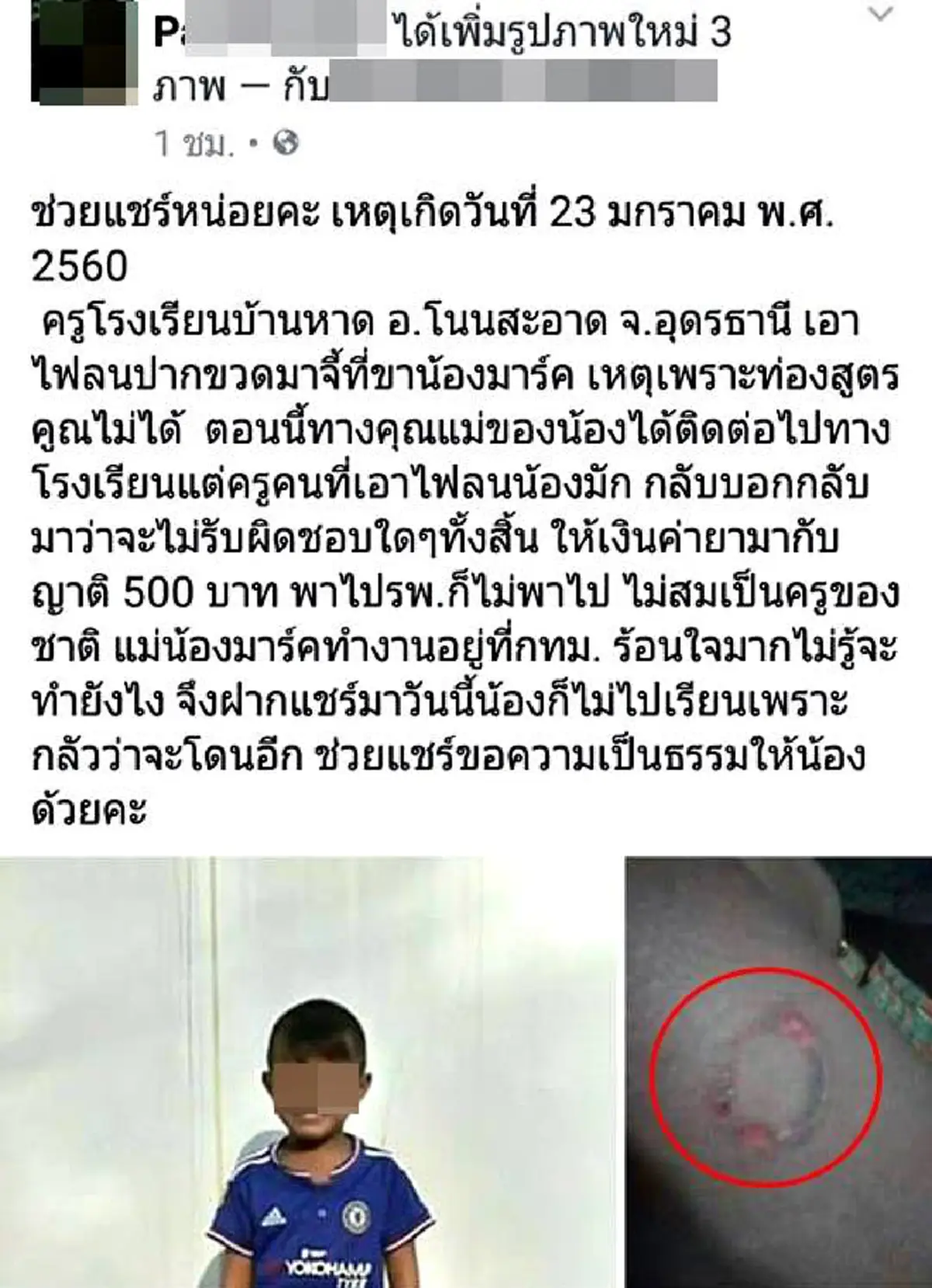 ชาวเน็ตรุมจวกยับ!!! หลังสาวโพสต์ร้องเพจดัง "หลานท่องสูตรคูณไม่ได้" เจอครูใจยักษ์ทำโทษ เอาไฟลนปากขวดมาจี้ที่ขา แถมไม่รับผิดชอบ!!! 