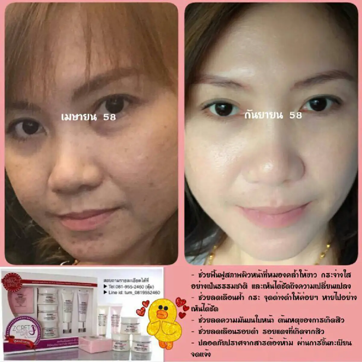 ใครหน้าพัง!!ฟังทางนี้ เคล็ดลับความสวยอย่างเจ้าแม่แห่งวงการครีมโสมสาหร่าย ที่บอกต่อกันมานานกว่า10ปีแล้ว