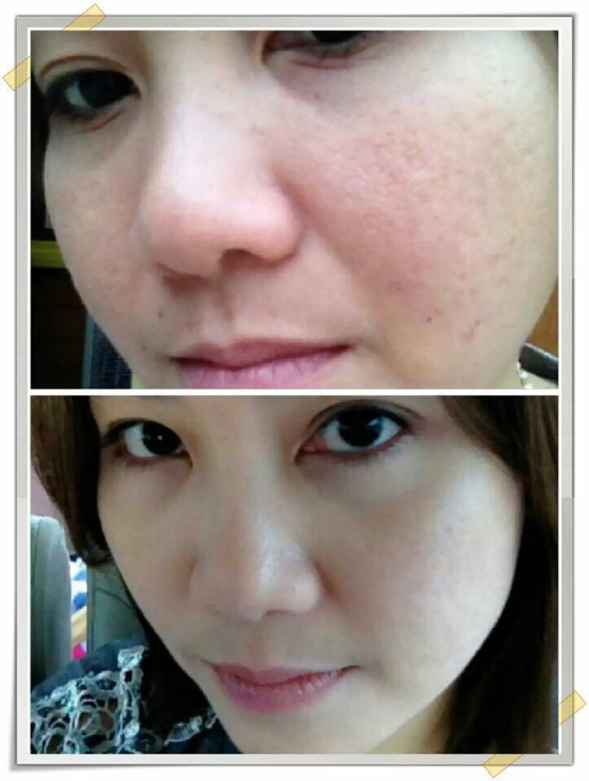 ใครหน้าพัง!!ฟังทางนี้ เคล็ดลับความสวยอย่างเจ้าแม่แห่งวงการครีมโสมสาหร่าย ที่บอกต่อกันมานานกว่า10ปีแล้ว