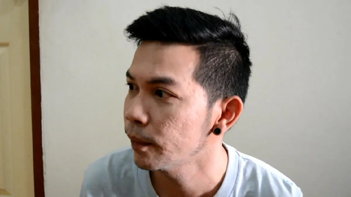 เปิดใจ!! "ธนะชัย" แพะคดีปล้นรถขนเงิน ถูกสังคมตราหน้าขี้คุก -ไร้งานทำ สลดซ้ำ!! พ่อ ช็อก ลูกถูกจับ กลายเป็นอัมพฤกษ์เดินไม่ได้!!