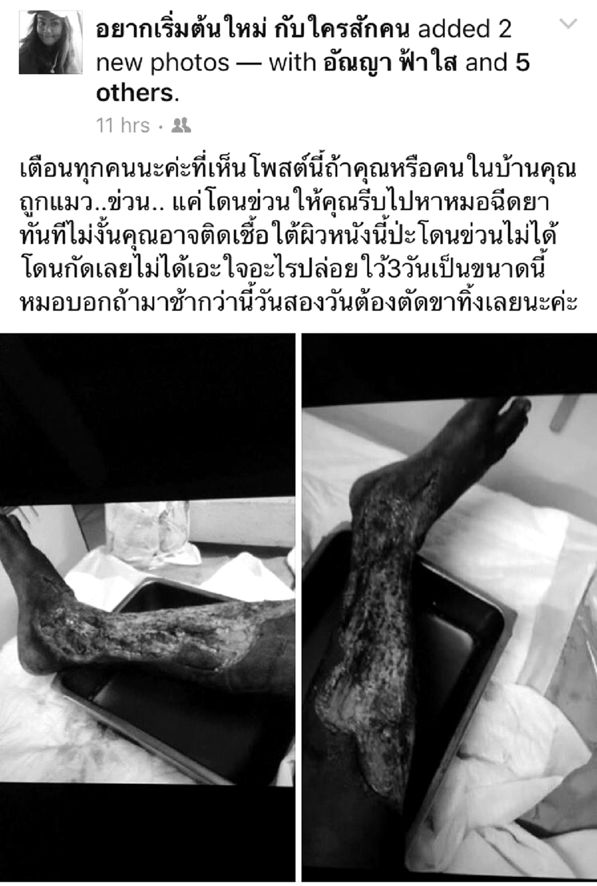 ช่วยกันแชร์เตือนภัย !!! สาวโพสต์เฟซบุ๊กพ่อสามีโดนเเมวข่วนที่ขา แต่ชะล่าใจไม่หาหมอ ผ่านไป 3วัน แผลเน่าติดเชื้อหนัก!?!