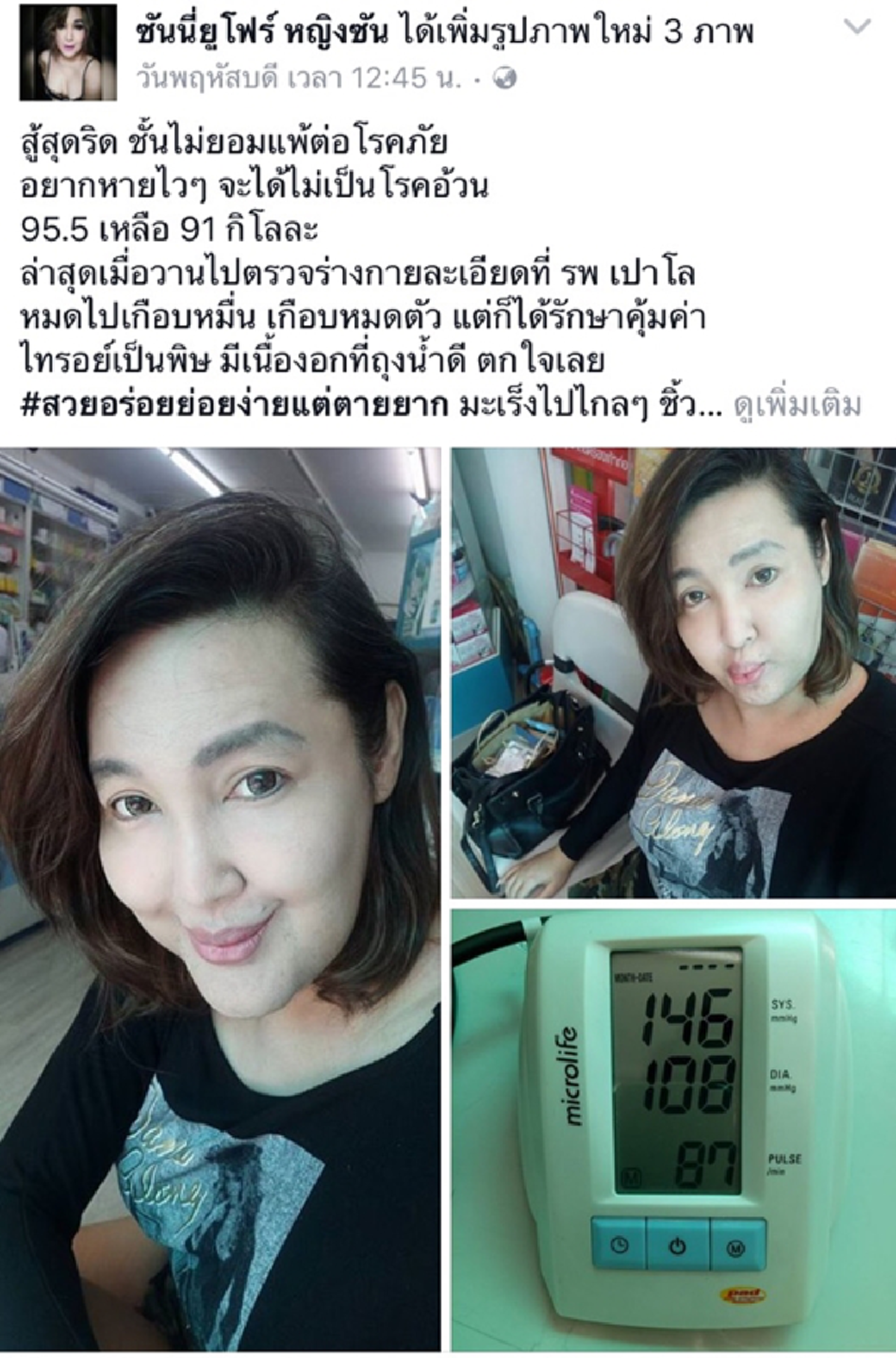 เปิดทุกซอกมุมชีวิต!!! "ซันนี่ ยูโฟร์" ป่วยไทรอยด์เป็นพิษล่าสุดเจอเนื้องอกอีก เผยทุกวันนี้เคยมีเงินล้านเหลือหลักหมื่น ทิ้งท้ายแฉยับวงการมายาไร้ความจริงใจ!!