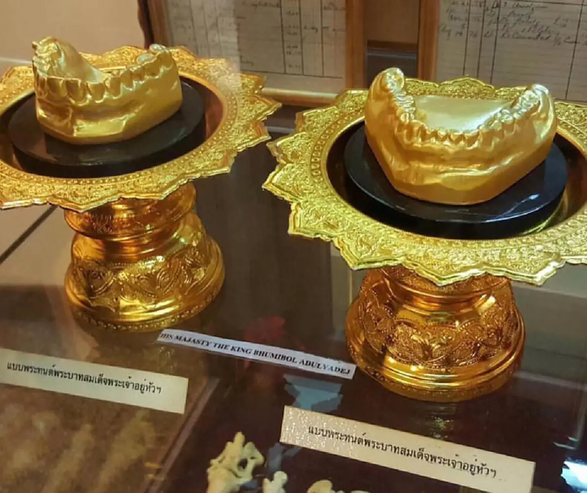 "เราทนได้ราษฎร์สำคัญกว่า"!! "ในหลวงร. ๙"รับสั่งขอเลื่อนถวายรักษาพระอาการทรงเสียวพระทนต์ แม้ทันตแพทย์ทูลทัดทาน เพราะทรงห่วงปชช.ทุกข์น้ำท่วม  