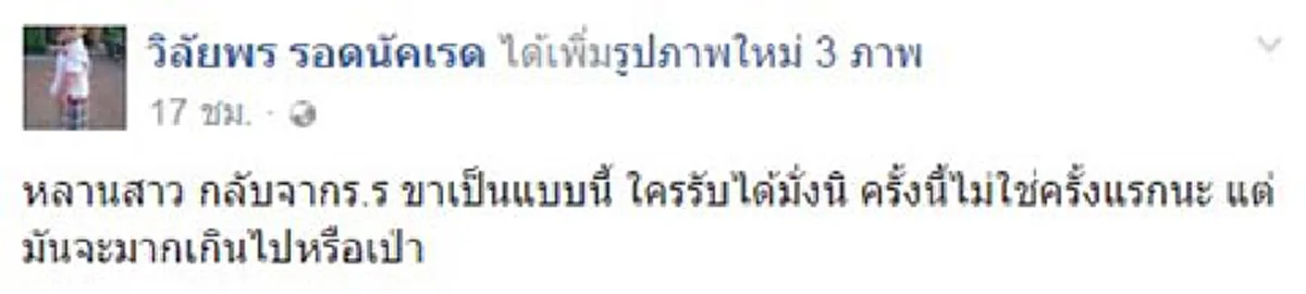 เกินไปหรือเปล่า?? สาวใหญ่โพสต์ภาพ "หลานสาวถูกเฆี่ยน" ขาแผลเป็นทางยาว เหตุเพราะไม่ขึ้นละหมาด เผยนี่ไม่ใช่ครั้งแรก!!!