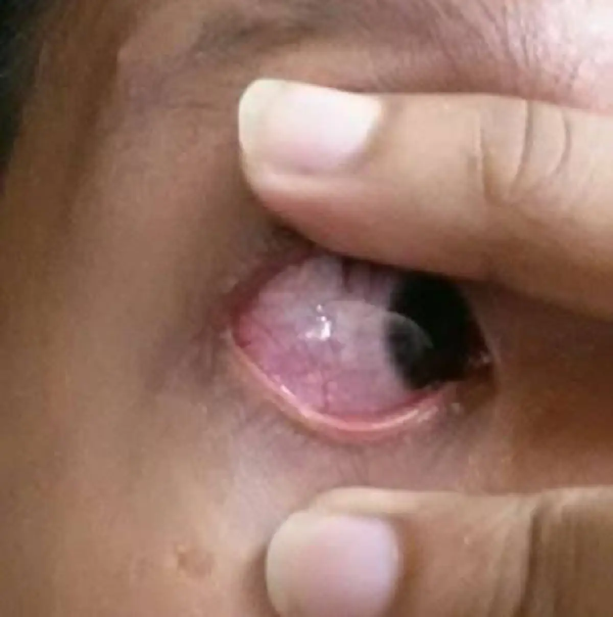 ท่านชายโปรดระวัง!!! หนุ่มโพสต์เตือน ขณะช่วยตัวเองไม่ทันระวัง พลาดน้ำอสุจิพุ่งเข้าตา??