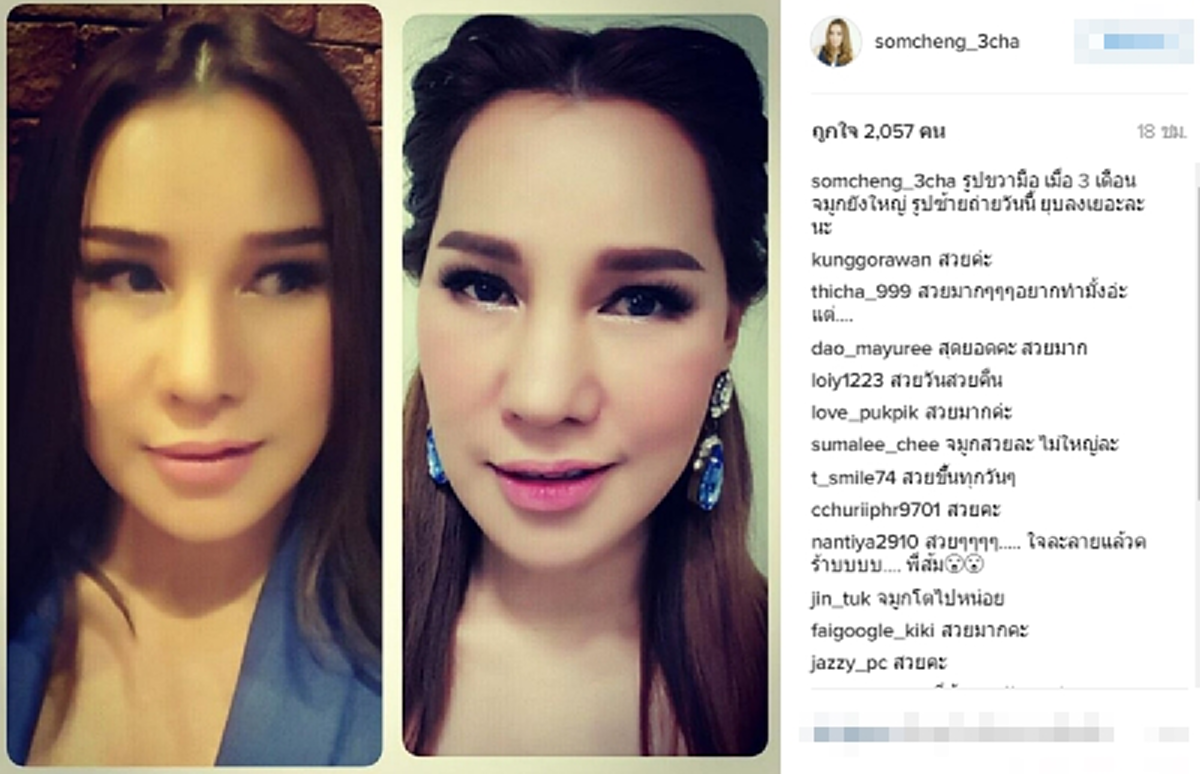 ดาราตลกตัวแม่ ส้มเช้ง-สามช่า เธอมาไกลมากจริงๆ แค่ 5 เดือนหลังบินลัดฟ้าอัพหน้า ล่าสุดเปลี่ยนไปถึงขนาดนี้ !! (ชมภาพ) 