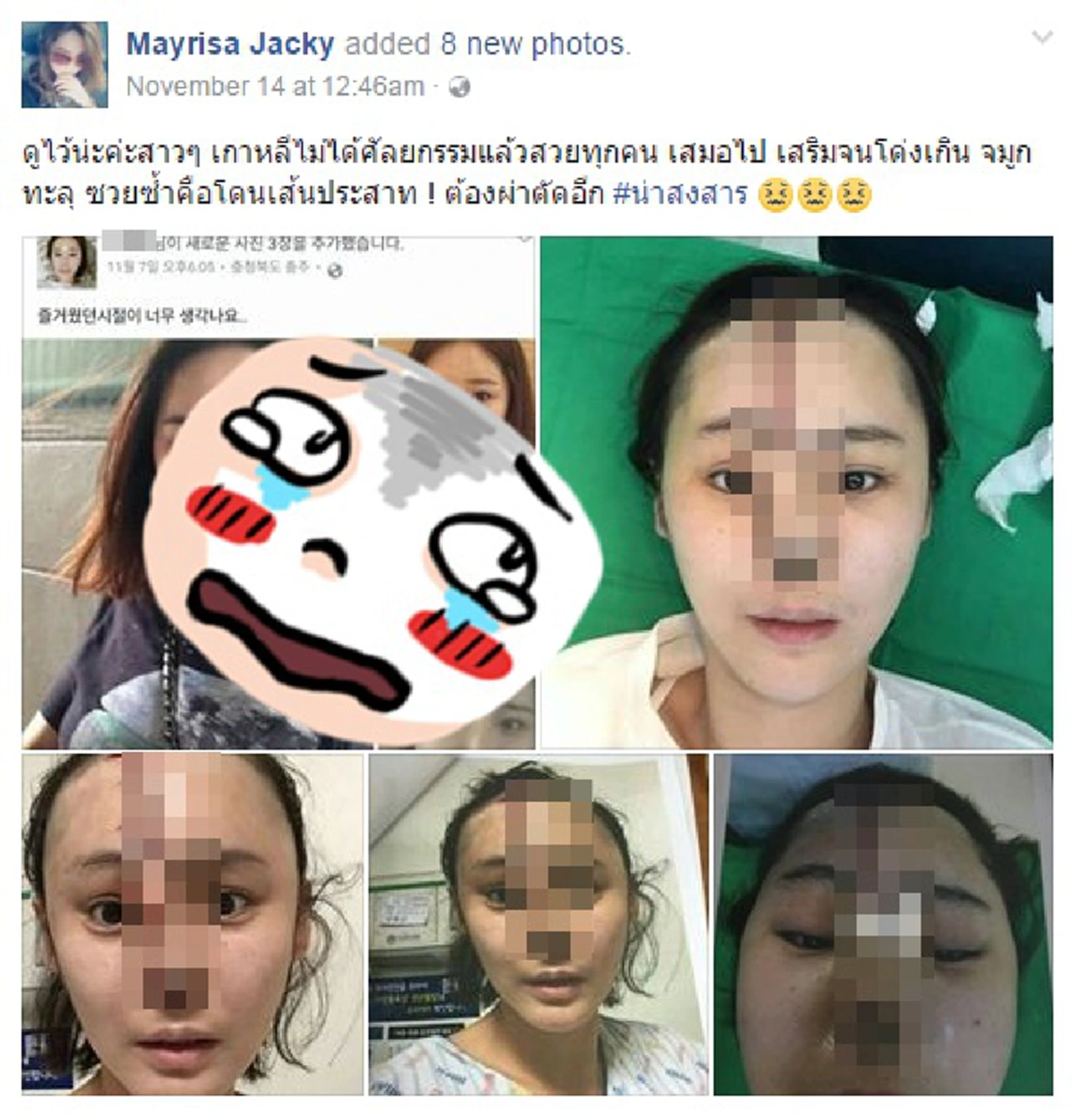 ถึงกับขนลุก!!! สาวโพสต์เตือนหลังสาวเกาหลีโดนพิษศัลยกรรม บอกเลยเห็นภาพแล้วอดซู้ดปากไม่ได้ งานนี้ขยาดเลยมั้ยเนี่ย??? (มีภาพ)